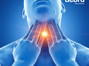 NEW! Management of Oesophageal Strictures in Inherited EB: a Clinical Practice Guideline now published