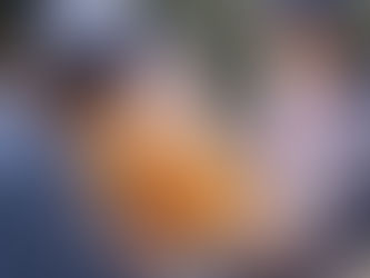 🏥 Caso de Éxito en AngioSmart: Fístula Arteriovenosa Antecubital para Paciente Joven con Enfermedad Renal Crónica.