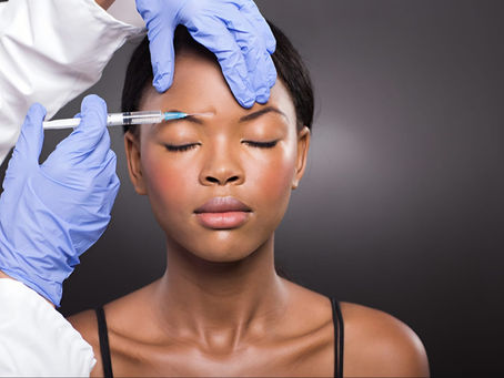 Achieve Youthful Skin: Botox Before-After Gallery