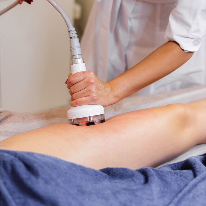 cavitation-process.jpg