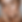 Xemin injectables Beverly Aesthetics