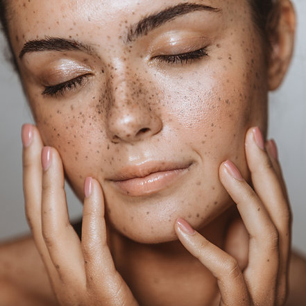 Xemin injectables Beverly Aesthetics