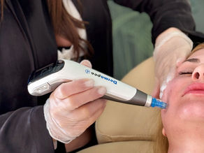 Dermapen 4 Nedir? Ne İşe Yarar?