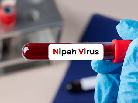 Nipah virus