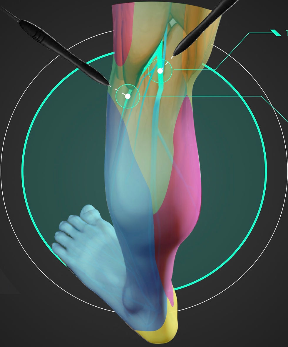 Pulse Radiofrequecy Therapy