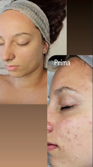 prima e dopo