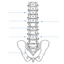 Cauda Equina Syndrome: An Overview