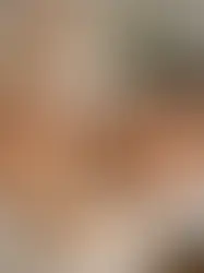 근육 긴장 완화 마사지, 정말 필요한 순간
