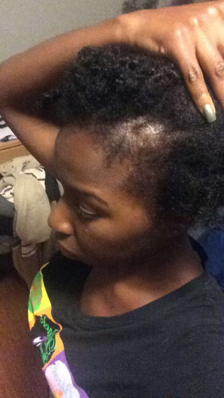 Thumbnail: How to Regrow Your Edges E-book