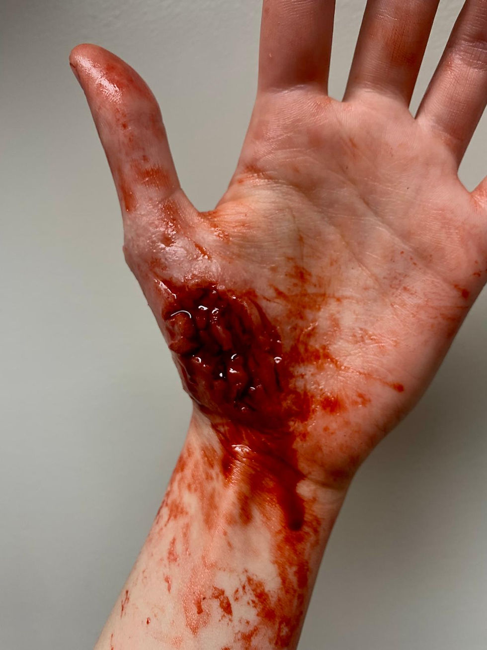 Thumbnail: Silicone Gnarly Gash Prosthetic