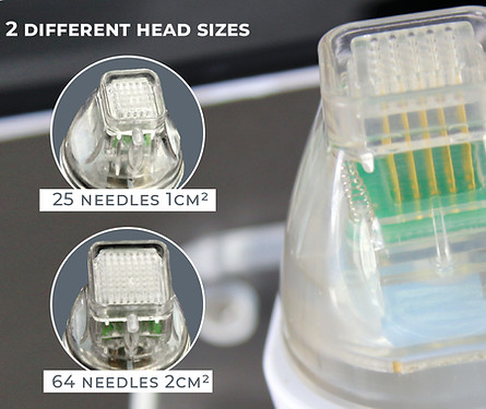 Radio Frequency Microneedling