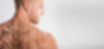 Laser Tattoo Removal On Man's Shoulder Against White Background_edited.jpg