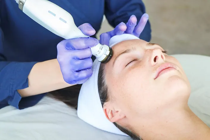 plason acne treatment