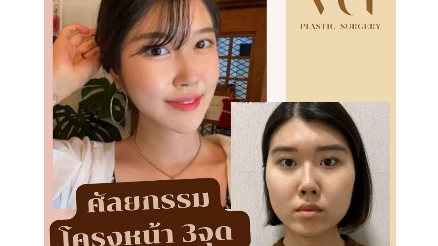 ศัลยกรรมโครงหน้า 3 จุด (ตอนที่ 1)
