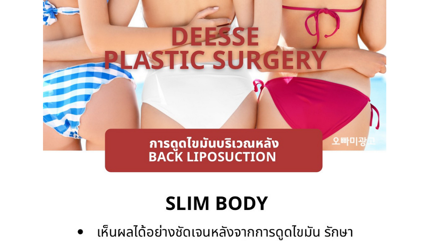 การดูดไขมันบริเวณหลัง (ตอนที่ 1)