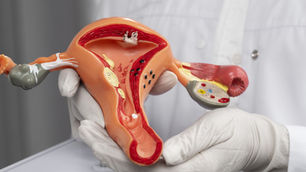 Como É Realizado o Procedimento de Punção Ovariana?