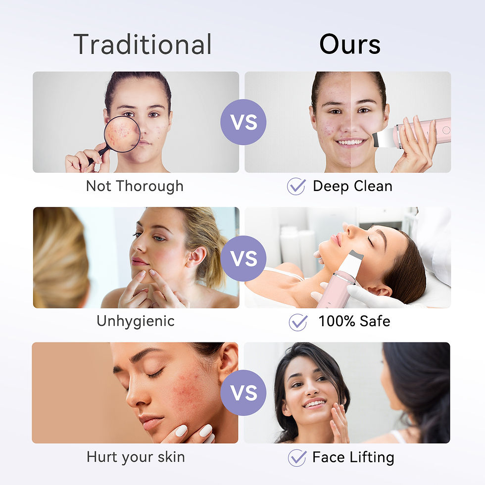 Thumbnail: ANLAN Ultrasonic Skin Scrubber Facial Pore Cleansing Spatula Microcurrent Facial