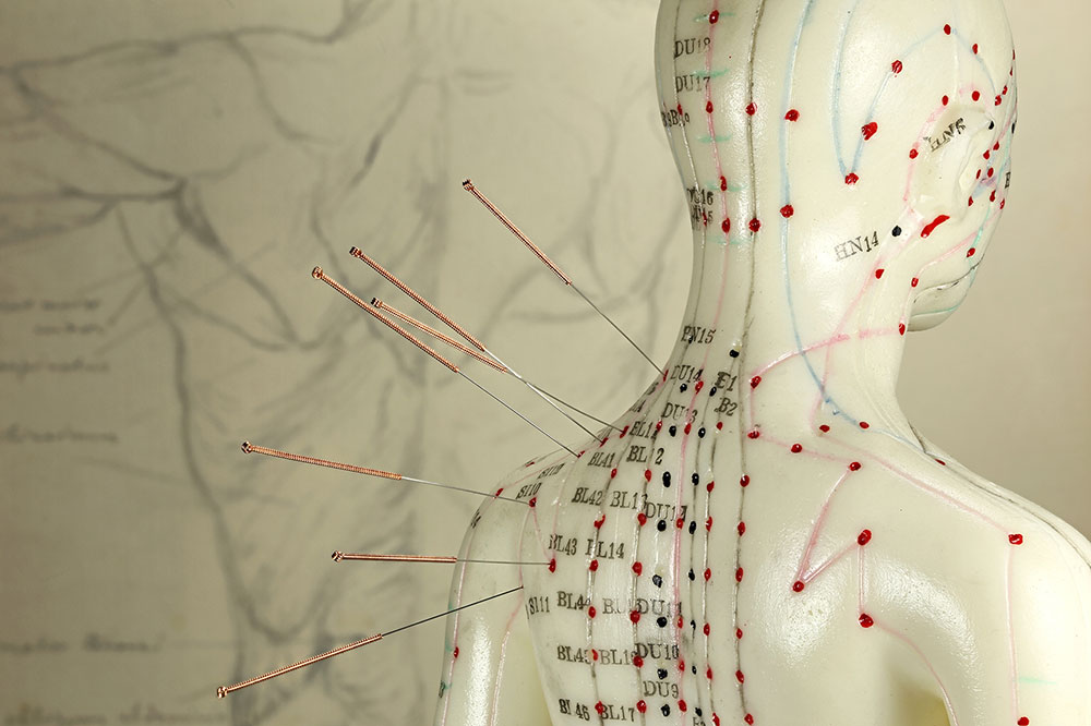 Medical Acupuncture.jpg