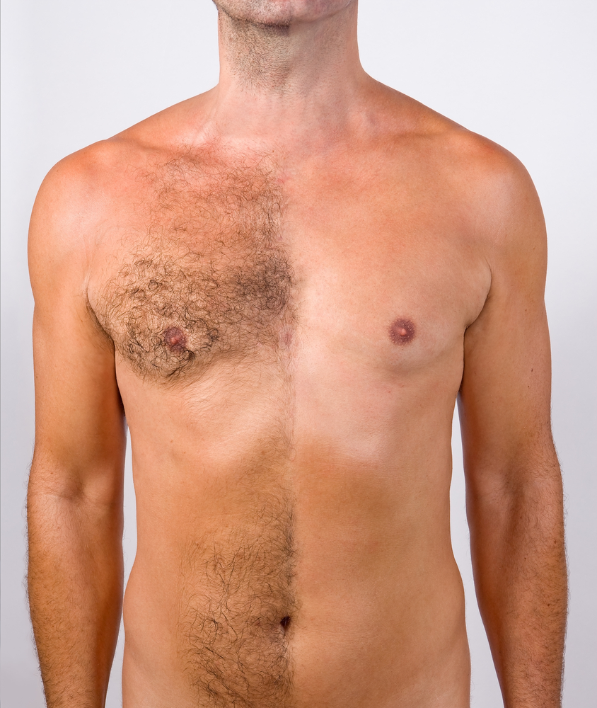 shutterstock_37261684.jpg.webp