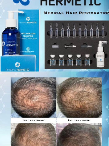 Hair Growth Treatment