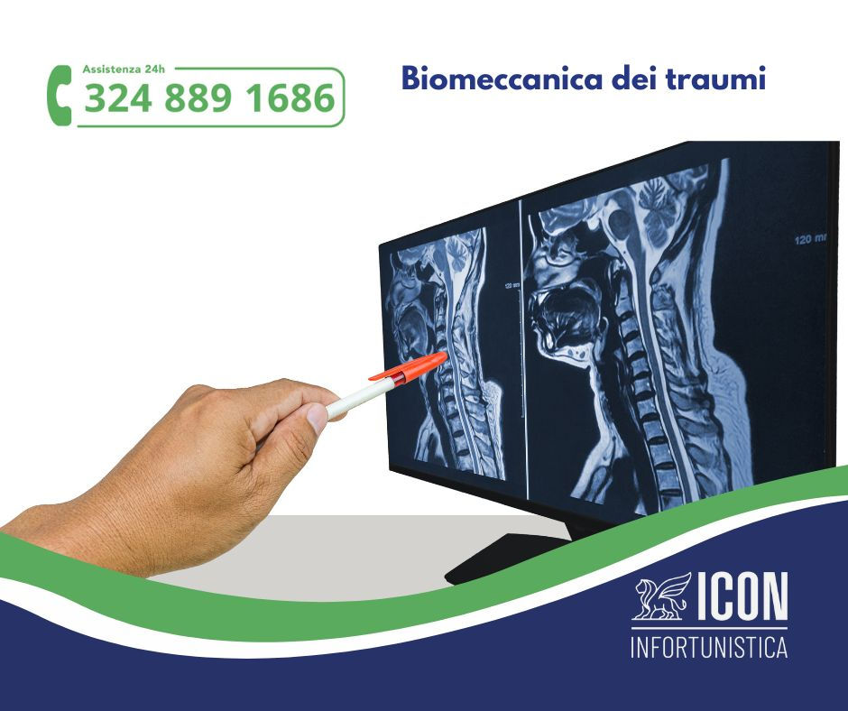 Biomeccanica dei traumi