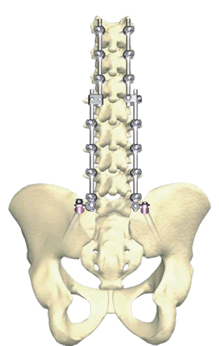 XIA 3 system