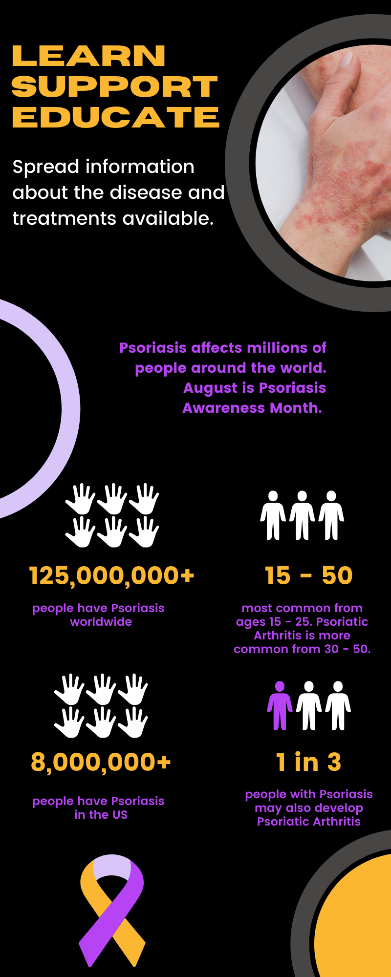 Psoriasis Infographic