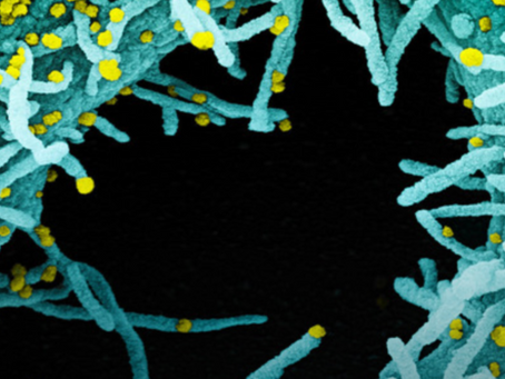 La microscopía electrónica de barrido y transmisión revela óxido de grafeno en las vacunas CoVID-19