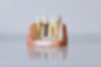 Dental Implant