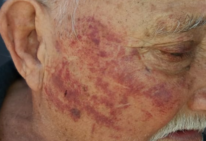 Idoso é espancado pela própria filha em Joaçaba