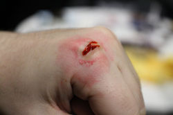 Workshop Basic wounds Demo