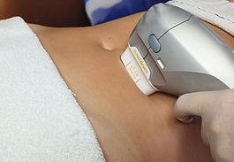 quartzo estética avançada depilação a laser botox preenchimento ácido hialurônico lavieen