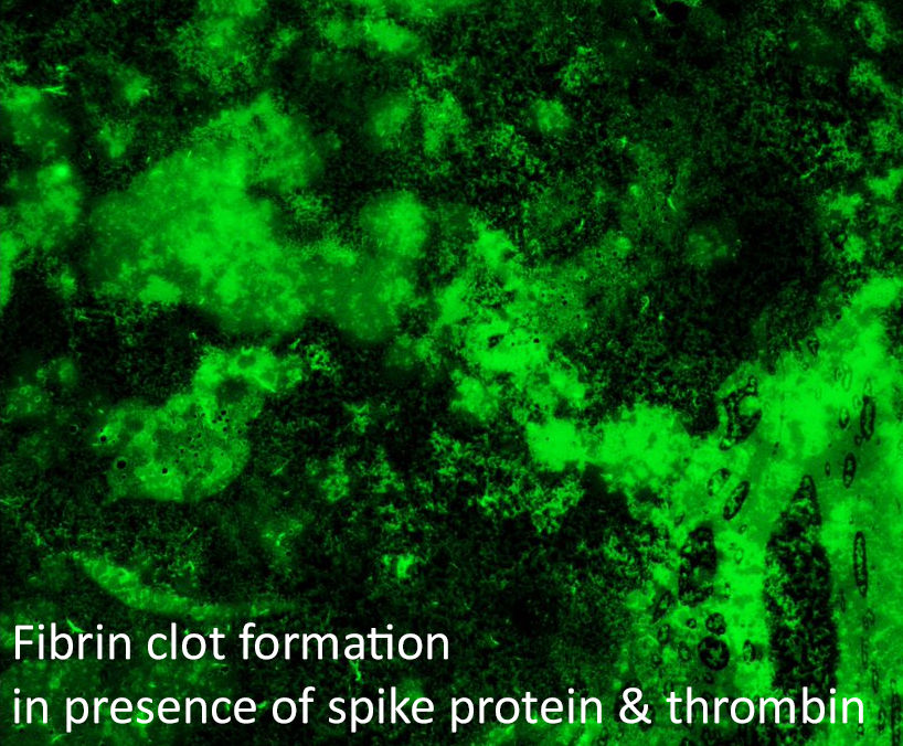 Fibrin clot formation in presence of spike protein and thrombin.