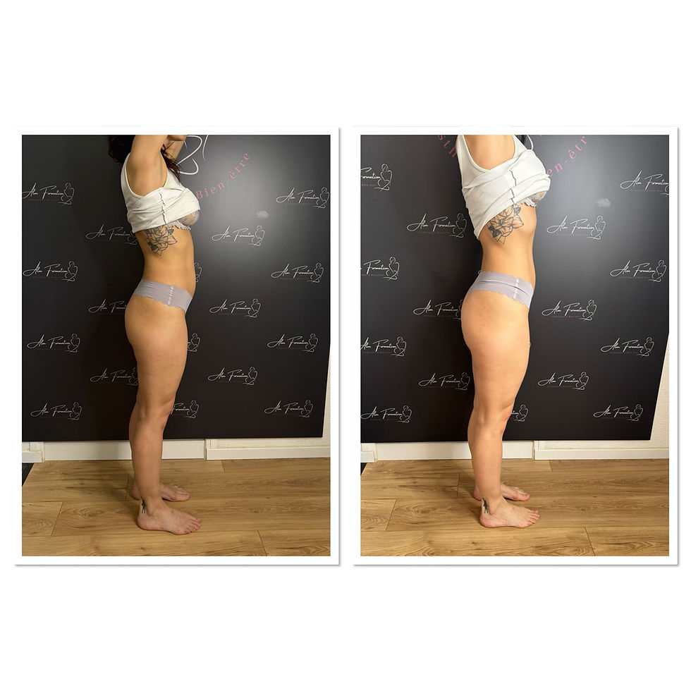 Vue de profil après drainage lymphatique brésilien à Pau au Namasté Studio, silhouette affinée et réduction des œdèmes visible dès la première séance