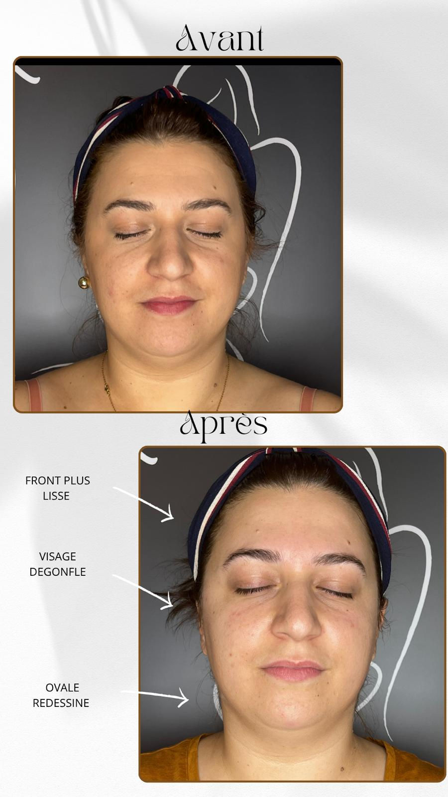 Avant massage liftant japonais à Pau au Namasté Studio, visage avant soin facialiste