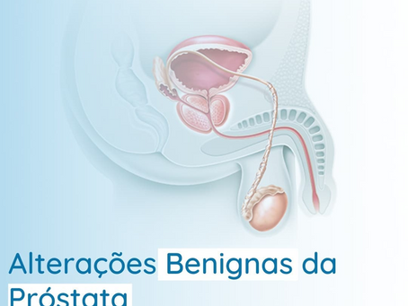 ALTERAÇÕES BENIGNAS DA PRÓSTATA