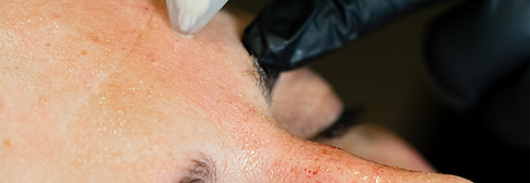 tratamento para alterações musculares e tensionais