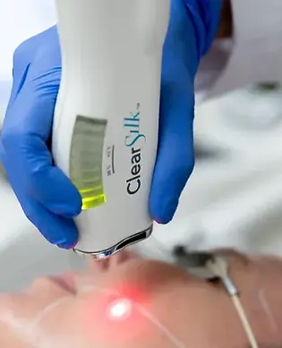 Traitement au laser ClearSilk