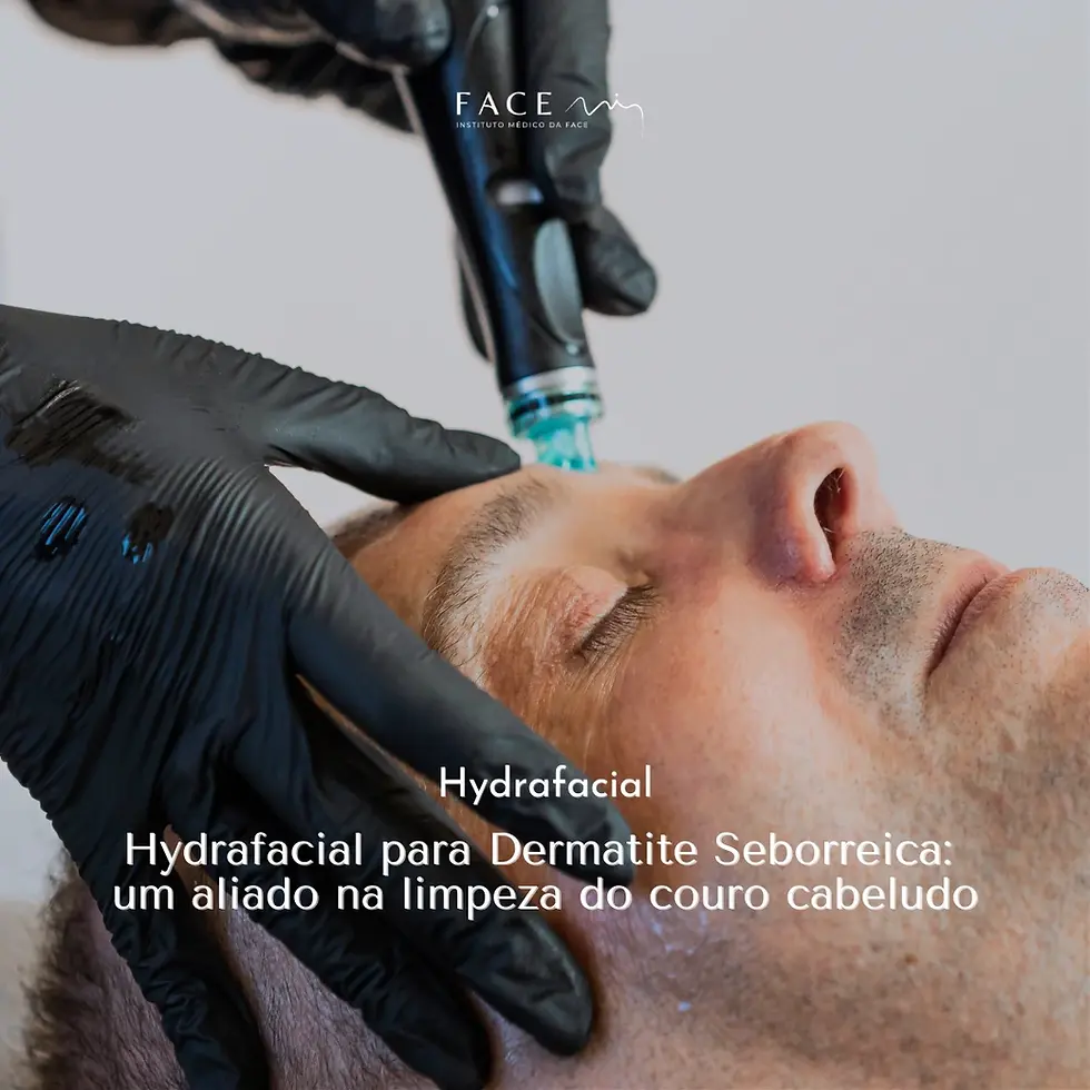 Hydrafacial para Dermatite Seborreica: um aliado na limpeza do couro cabeludo