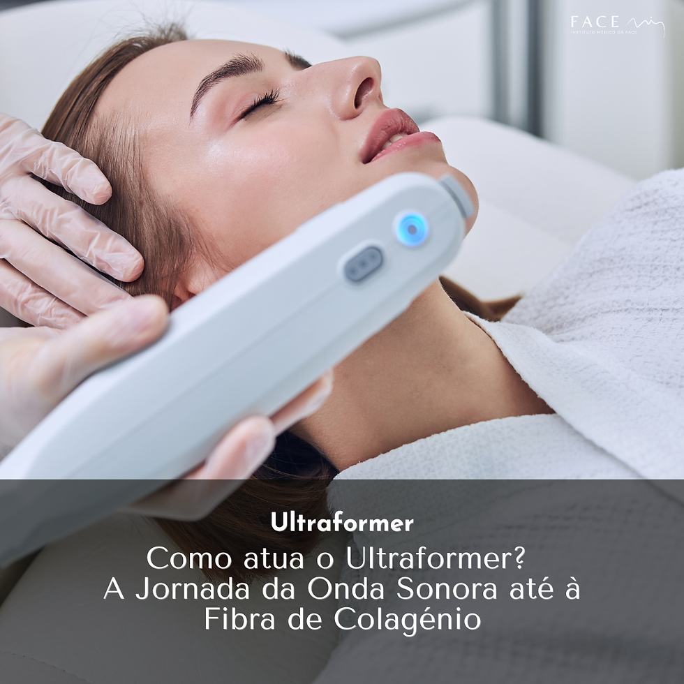 Como atua o Ultraformer? A Jornada da Onda Sonora até à Fibra de Colagénio