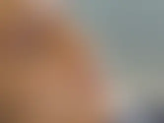 Rinomodelação vs Rinoplastia: Descubra como melhorar o seu perfil sem cirurgia