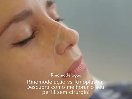 Rinomodelação vs Rinoplastia: Descubra como melhorar o seu perfil sem cirurgia
