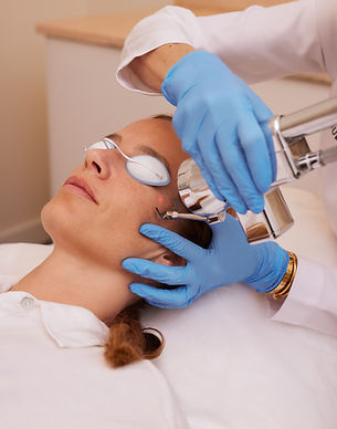 Tratamiento láser ProFractional