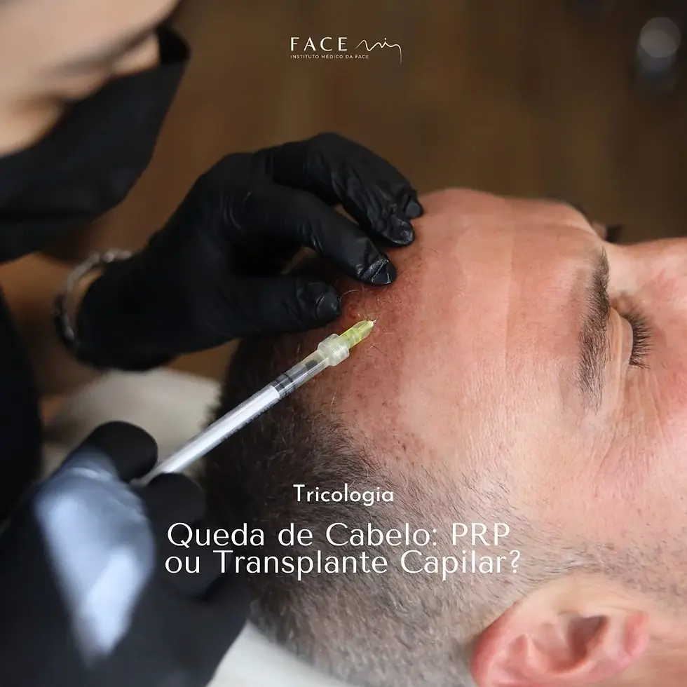 Queda de Cabelo: PRP Capilar ou Transplante Capilar?