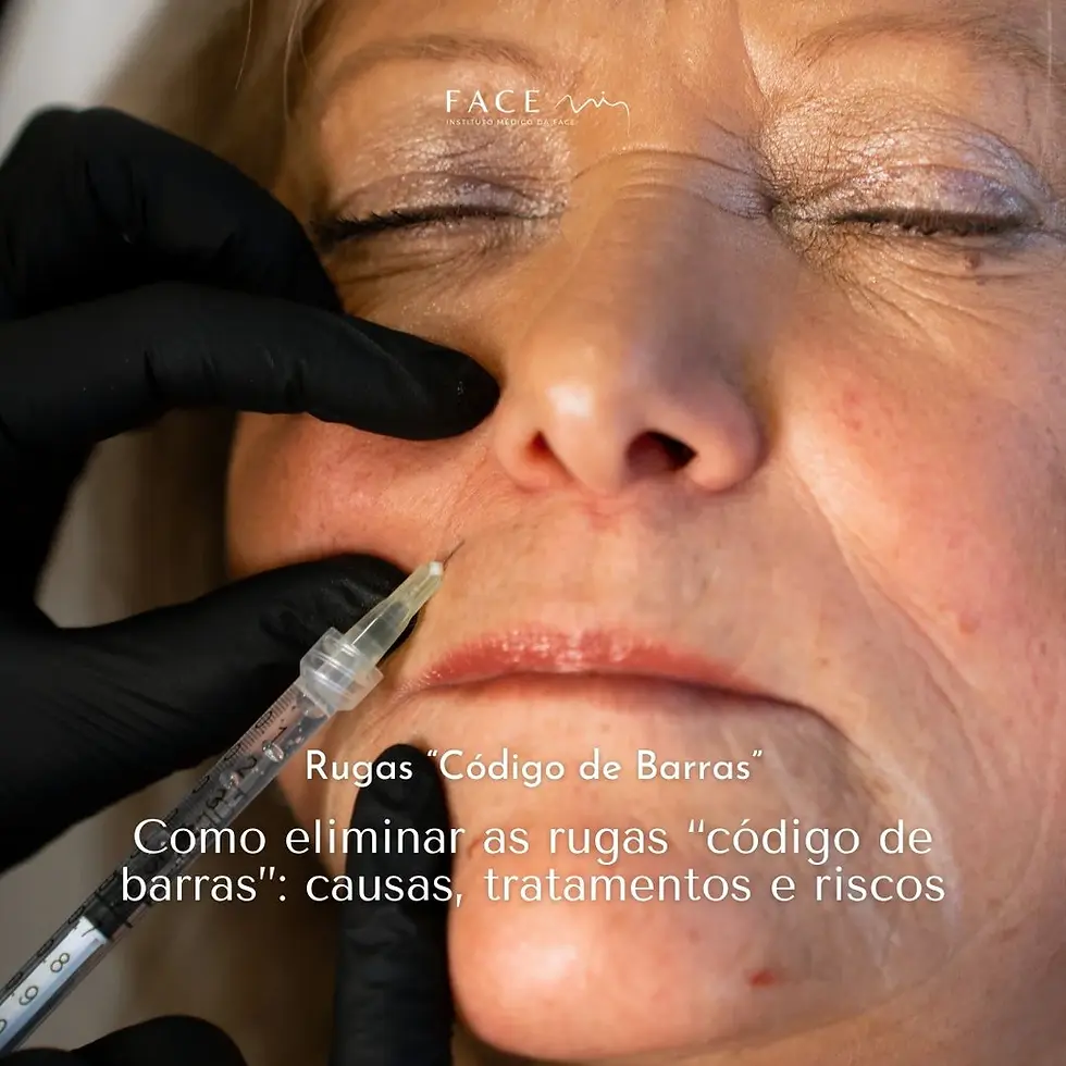 Como eliminar as rugas “código de barras”: Causas, tratamentos e riscos