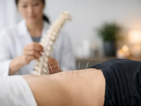 Acupuncture for Sciatica Relief: Does It Help?