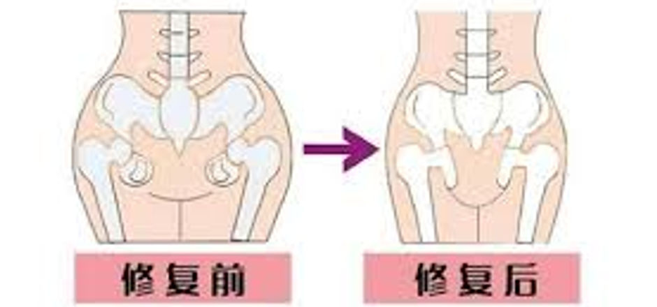 pelvic.jpg