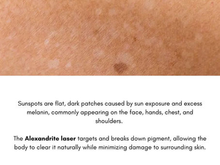 Understanding Common Pigmented Skin Lesions