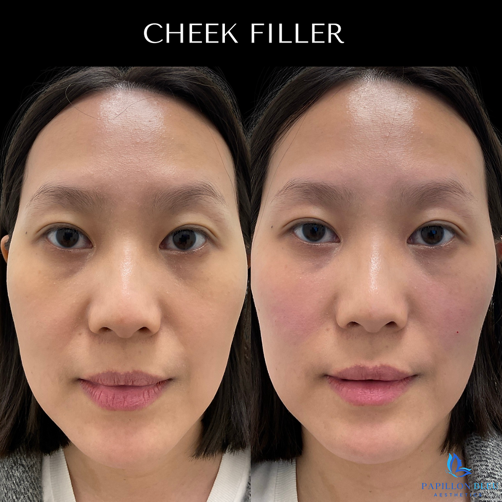 Before & after template (8) copy 2