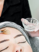 chemical-peel-1.jpg